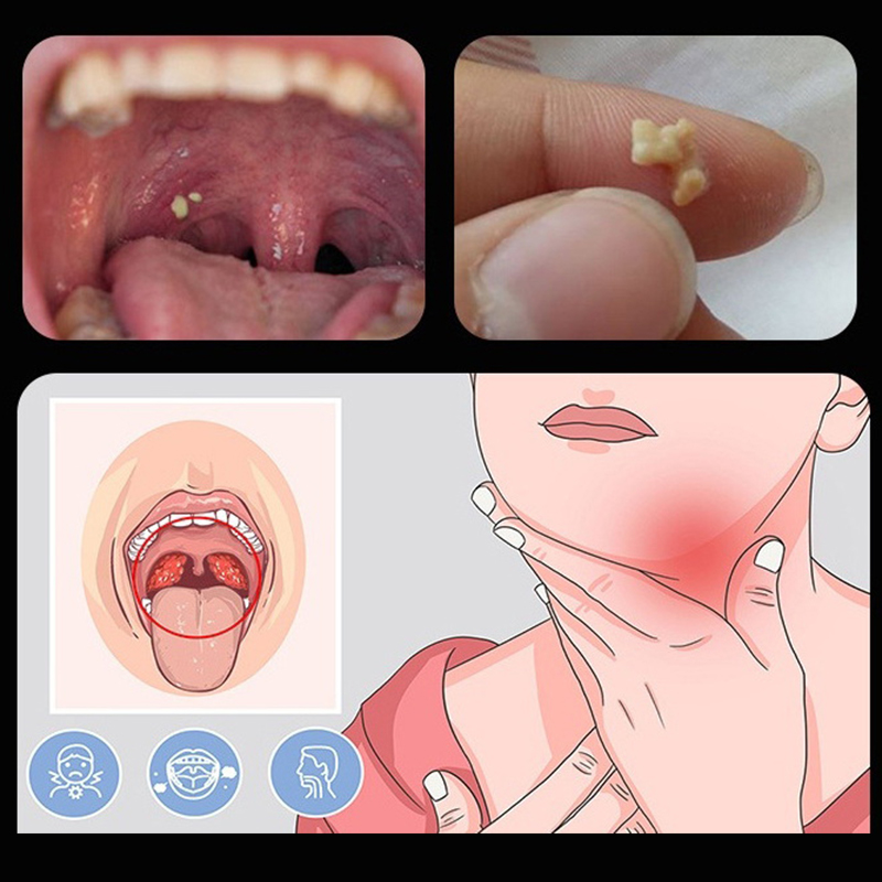 ~Ear Wax Tonsil Stone Remover  - Ear Wax Remover review and price